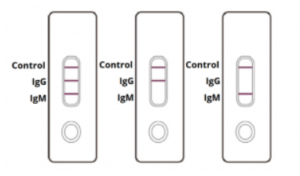 COVID-19 Antibody Rapid Test Results