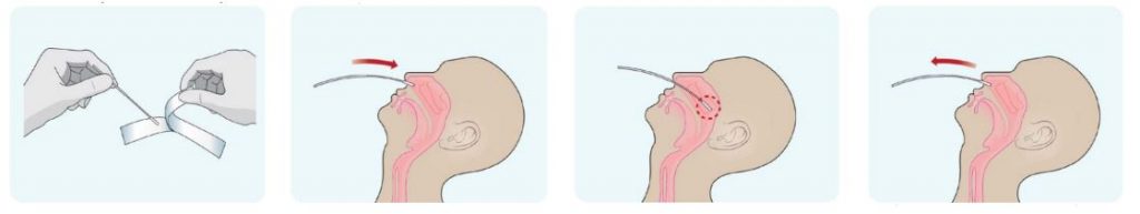 COVID-19 Antigen Test Kit Sample Collection