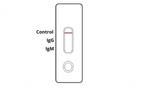 COVID-19 Antibody Rapid Test Results