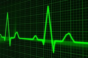 Aurora Contract Research services, ICR8100, Ion Channel Reader, Proarrhythmic Liability