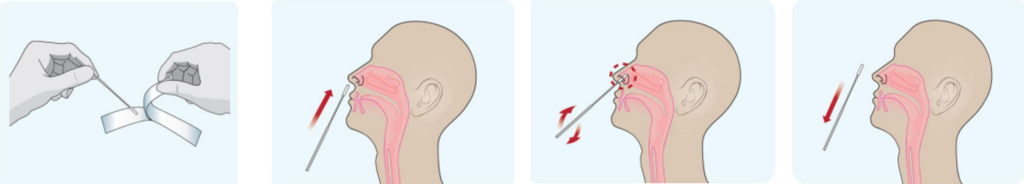 Nasal-swab, How to tell if you have COVID-19 or just the seasonal flu?