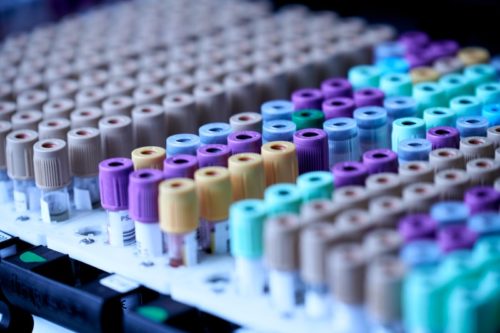 Pros and Cons of COVID-19 Antigen, RT-PCR, Antibody test