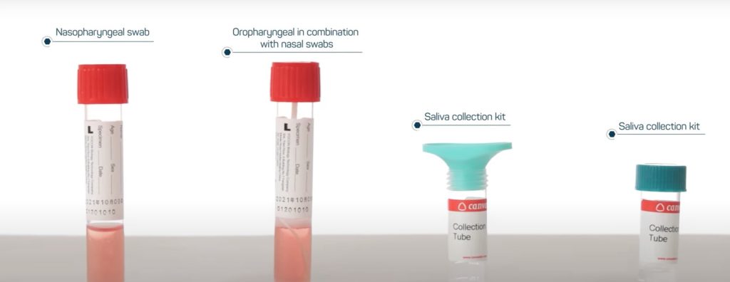 COVID-19 Molecular testing in remote places. Photo of the four HYRIS’s bKIT trademark. Saliva collection kit, nasopharyngeal swab.