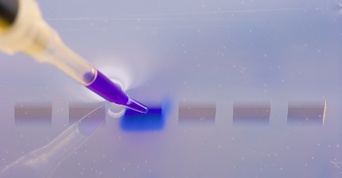 DNA Gel Electrophoresis