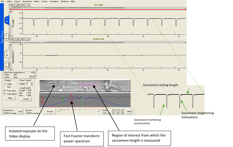 Myocardial contractility